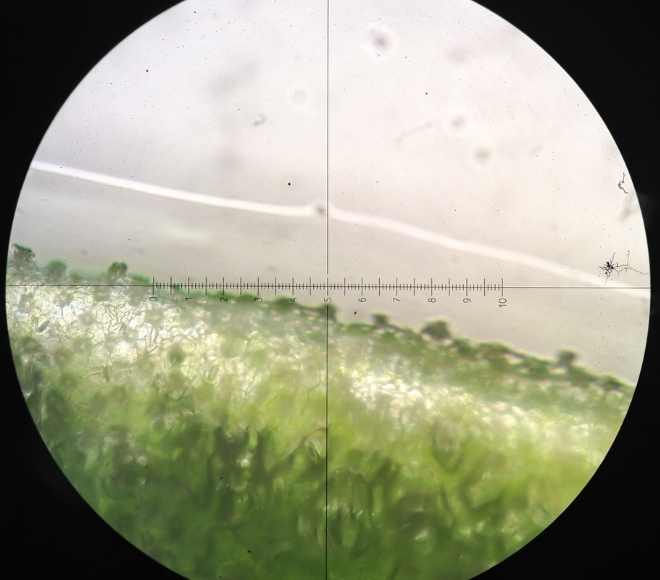 borde-microscopico-floema