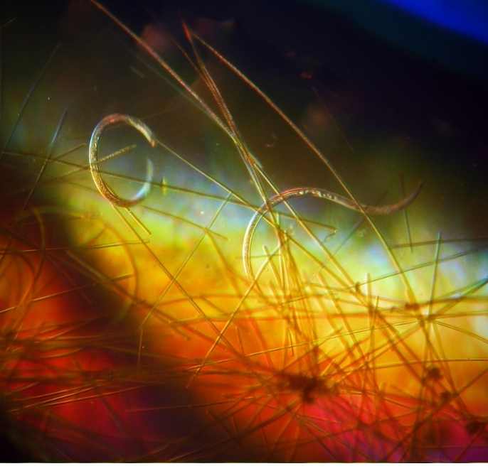 nematodo-xiphinema-ectoparasito