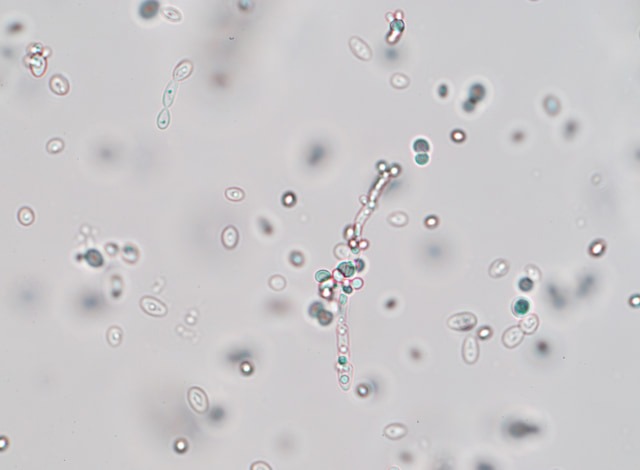 celula-de-levadura-en-ciernes-bajo-el-microscopio