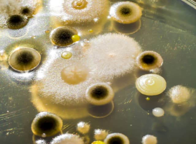 colonias-de-diferentes-bacterias-y-hongos